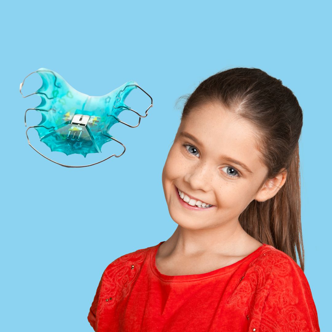 ortodonzia intercettiva