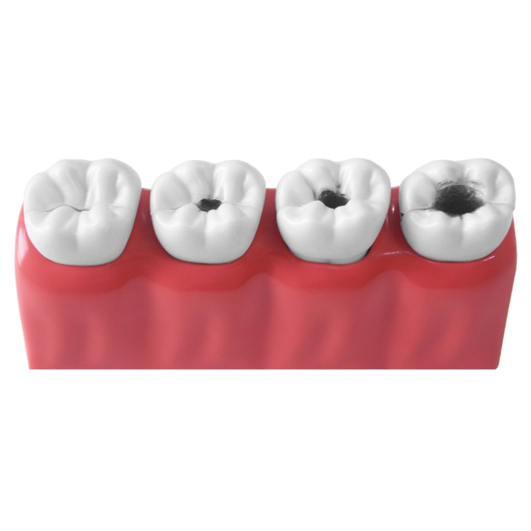 studio-dentistico-monforte-implantologia